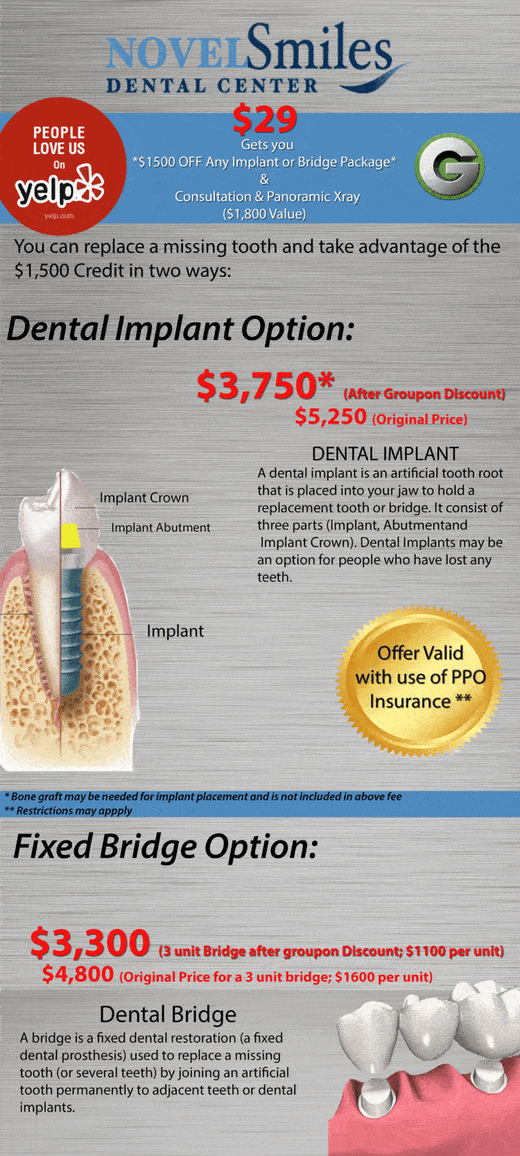 Dental Implants Groupon