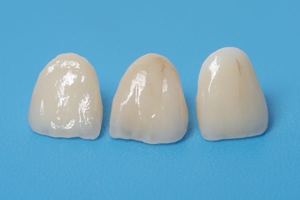How To Take Care Of A Dental Crown