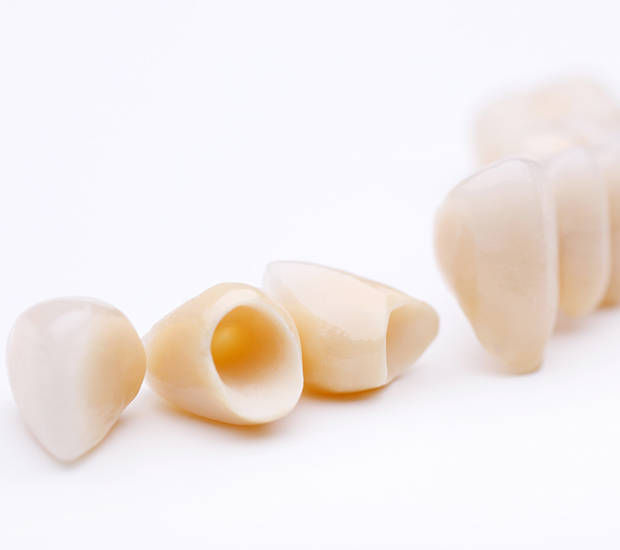 McLean Dental Crowns and Dental Bridges