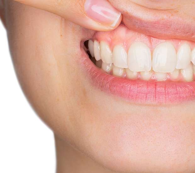 McLean Gum Disease