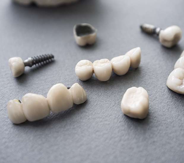 McLean The Difference Between Dental Implants and Mini Dental Implants