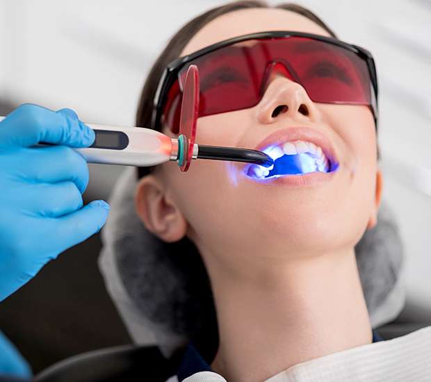 McLean Professional Teeth Whitening