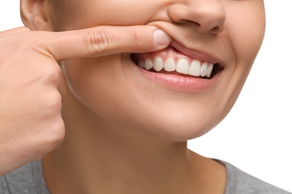 Find A Dentist For Professional Teeth Whitening