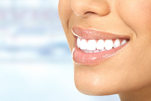 Patients can prepare for teeth whitening by scheduling at a convenient time and understanding the results they should expect  from Novel Smiles in McLean, VA